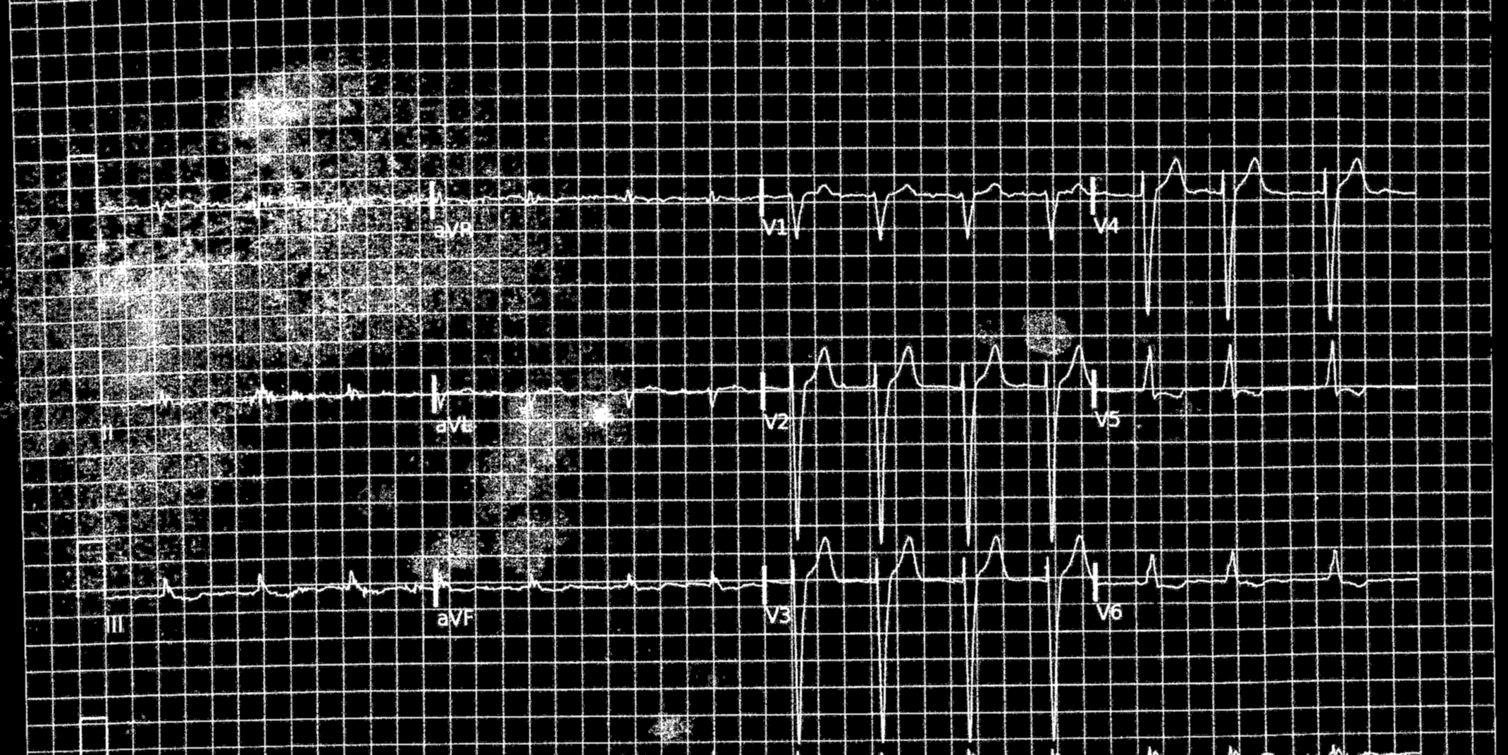 Binario dañado en test-0012